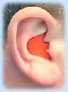 Defendear ear plug correctly inserted